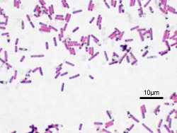 Bactérie Gram+ : Bacillus subtilis. Les bactéries sont colorées en violet.